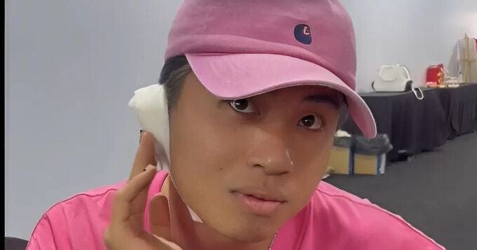 Kiên Ứng kiên cường tập luyện dù thính lực giảm 50% sau phẫu thuật