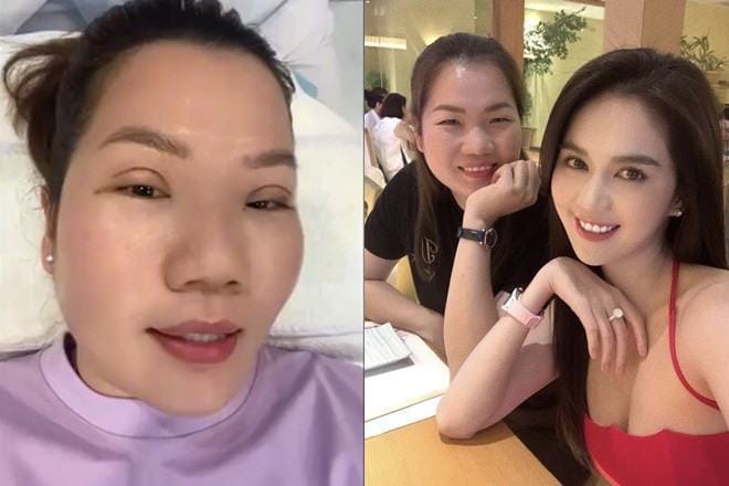 Thúy Kiều tiết lộ hành trình làm đẹp đầy bất ngờ