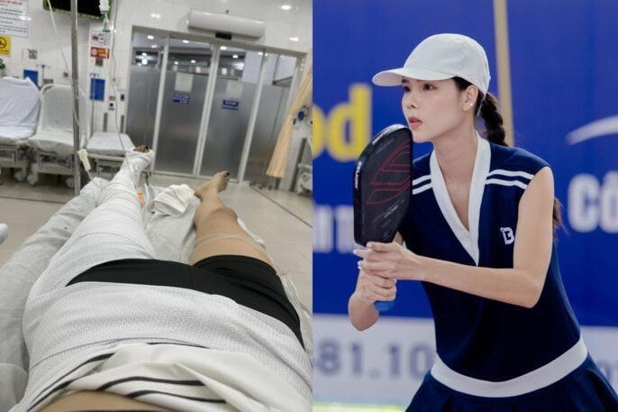Kỳ Hân gãy xương đùi vì đam mê pickleball