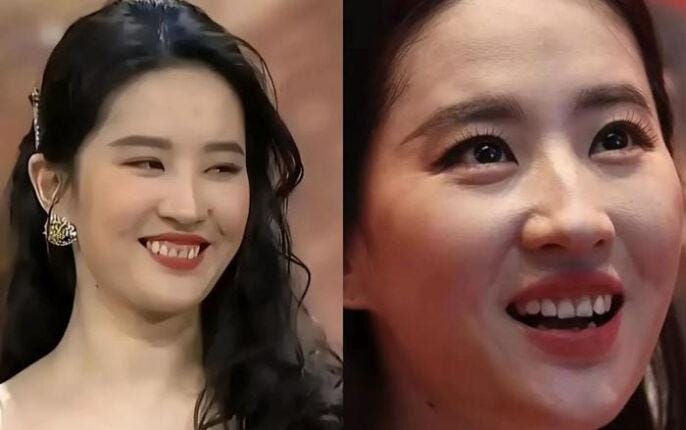 Sao Hoa Ngữ ‘đánh mất’ nhan sắc: Áp lực thẩm mỹ và cái giá phải trả