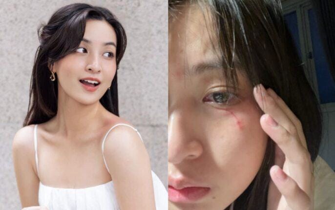 Thảo Tâm bị mèo cào vào mắt: Đau đớn và bối rối giữa đêm khuya