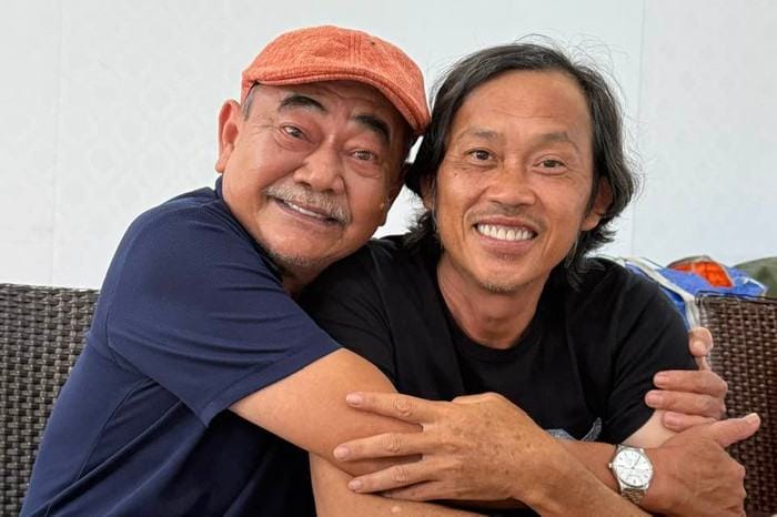 Diện mạo hiện tại của Hoài Linh được NSND Việt Anh chia sẻ. (Ảnh: FB Nguyễn Việt Anh)