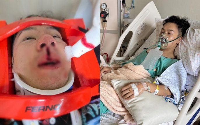 Tai nạn kinh hoàng: Nam ca sĩ Thái Lan gãy mũi, nứt răng sau cú va chạm